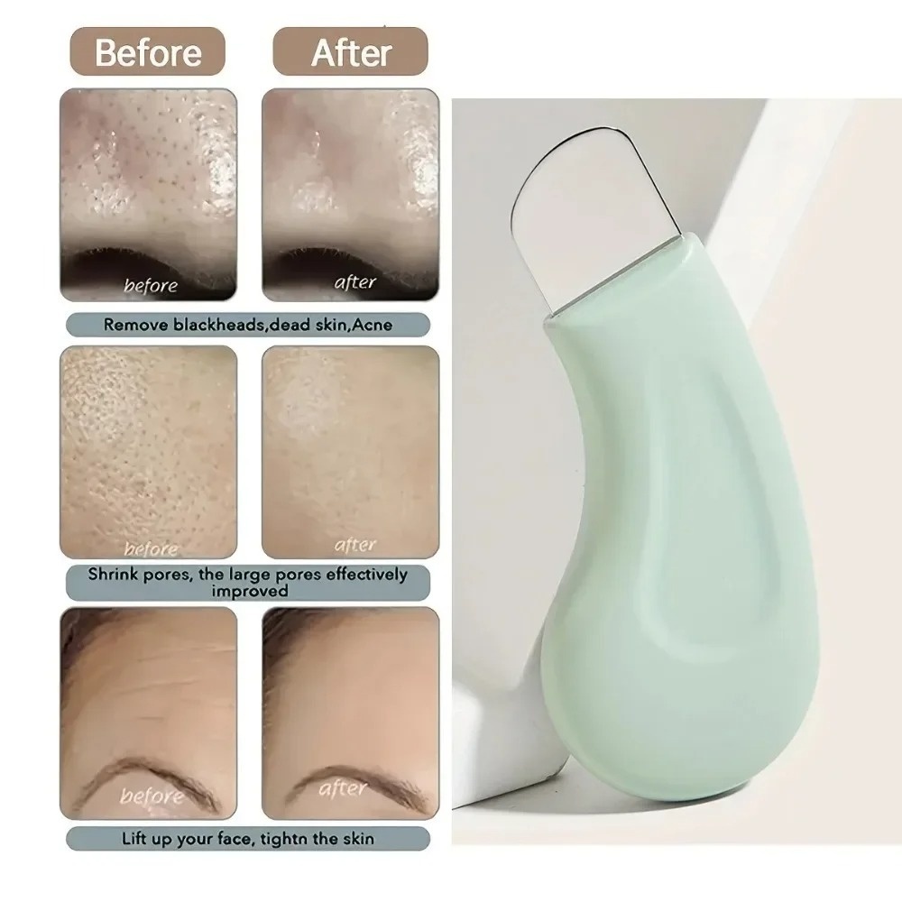 أداة تنظيف عميق لإزالة الرؤوس  - مراجعة Nasal Aspirator وسعره